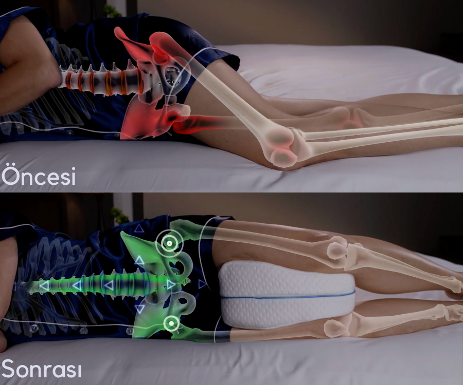 Pillowen® Bacak Arası Yan Yatış Yastığı
